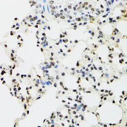 Anti-EDF1 antibody used in IHC (Paraffin sections) (IHC-P). GTX32571