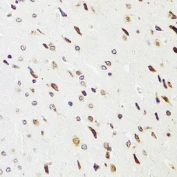 Anti-EDF1 antibody used in IHC (Paraffin sections) (IHC-P). GTX32571