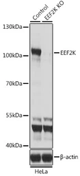 Anti-eEF2K antibody used in Western Blot (WB). GTX32573