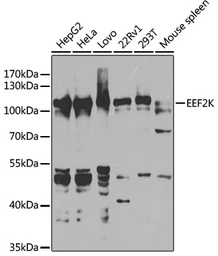 Anti-eEF2K antibody used in Western Blot (WB). GTX32573