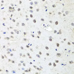 Anti-EIF2C2 antibody used in IHC (Paraffin sections) (IHC-P). GTX32577
