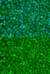 Anti-eIF4E antibody used in Immunocytochemistry/ Immunofluorescence (ICC/IF). GTX32580