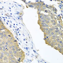 Anti-eIF4E antibody used in IHC (Paraffin sections) (IHC-P). GTX32580