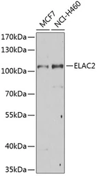 Anti-ELAC2 antibody used in Western Blot (WB). GTX32582