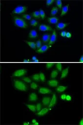 Anti-ELAC2 antibody used in Immunocytochemistry/ Immunofluorescence (ICC/IF). GTX32582