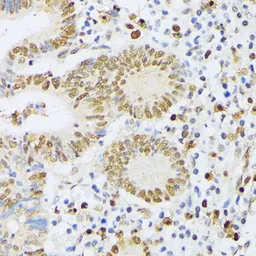 Anti-ELAC2 antibody used in IHC (Paraffin sections) (IHC-P). GTX32582