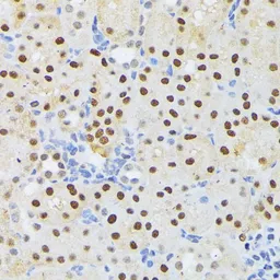 Anti-ELAC2 antibody used in IHC (Paraffin sections) (IHC-P). GTX32582