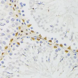 Anti-ELAC2 antibody used in IHC (Paraffin sections) (IHC-P). GTX32582