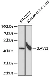 Anti-ELAVL2 antibody used in Western Blot (WB). GTX32583