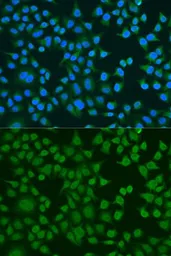 Anti-ELAVL2 antibody used in Immunocytochemistry/ Immunofluorescence (ICC/IF). GTX32583