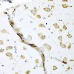 Anti-ELAVL2 antibody used in IHC (Paraffin sections) (IHC-P). GTX32583