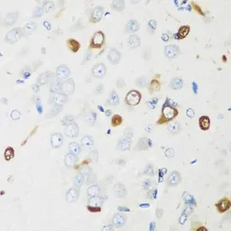 Anti-ELAVL2 antibody used in IHC (Paraffin sections) (IHC-P). GTX32583