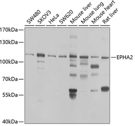 Anti-EphA2 antibody used in Western Blot (WB). GTX32587