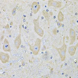 Anti-EphA2 antibody used in IHC (Paraffin sections) (IHC-P). GTX32587