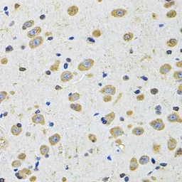 Anti-EphA2 antibody used in IHC (Paraffin sections) (IHC-P). GTX32587