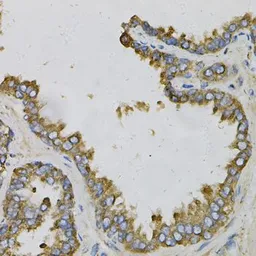 Anti-Ephrin A1 antibody used in IHC (Paraffin sections) (IHC-P). GTX32588