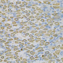Anti-Ephrin A1 antibody used in IHC (Paraffin sections) (IHC-P). GTX32588