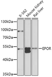 Anti-EPO receptor antibody used in Western Blot (WB). GTX32590