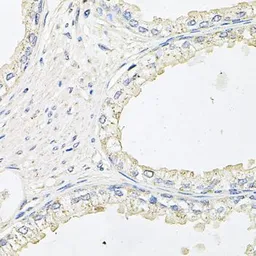 Anti-EPO receptor antibody used in IHC (Paraffin sections) (IHC-P). GTX32590