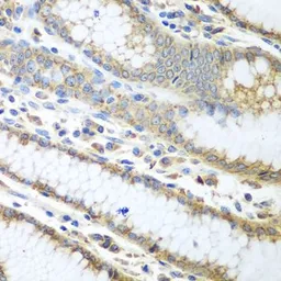 Anti-ERp57 antibody used in IHC (Paraffin sections) (IHC-P). GTX32592