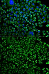 Anti-Factor X antibody used in Immunocytochemistry/ Immunofluorescence (ICC/IF). GTX32595