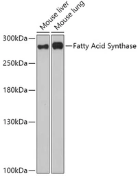 Anti-Fatty Acid Synthase antibody used in Western Blot (WB). GTX32598