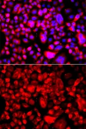 Anti-Fatty Acid Synthase antibody used in Immunocytochemistry/ Immunofluorescence (ICC/IF). GTX32598