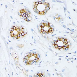 Anti-Fatty Acid Synthase antibody used in IHC (Paraffin sections) (IHC-P). GTX32598