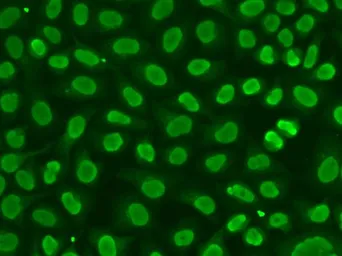 Anti-FEN1 antibody used in Immunocytochemistry/ Immunofluorescence (ICC/IF). GTX32600