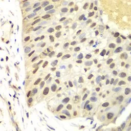 Anti-FEN1 antibody used in IHC (Paraffin sections) (IHC-P). GTX32600