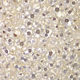 Anti-FEN1 antibody used in IHC (Paraffin sections) (IHC-P). GTX32600