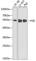 Anti-FGR antibody used in Western Blot (WB). GTX32602