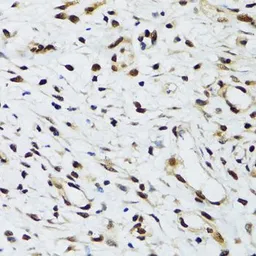 Anti-FLI1 antibody used in IHC (Paraffin sections) (IHC-P). GTX32607