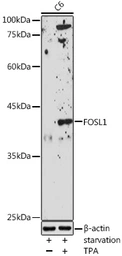 Anti-FRA1 antibody used in Western Blot (WB). GTX32609