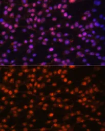 Anti-FRA1 antibody used in Immunocytochemistry/ Immunofluorescence (ICC/IF). GTX32609