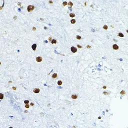 Anti-FRA1 antibody used in IHC (Paraffin sections) (IHC-P). GTX32609