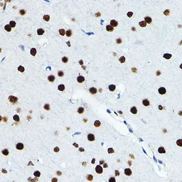 Anti-FRA1 antibody used in IHC (Paraffin sections) (IHC-P). GTX32609