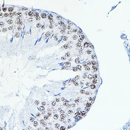 Anti-FRA1 antibody used in IHC (Paraffin sections) (IHC-P). GTX32609