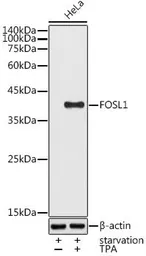 Anti-FRA1 antibody used in Western Blot (WB). GTX32609