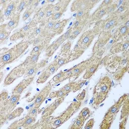 Anti-FUT6 antibody used in IHC (Paraffin sections) (IHC-P). GTX32612
