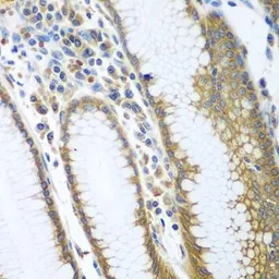 Anti-FUT6 antibody used in IHC (Paraffin sections) (IHC-P). GTX32612