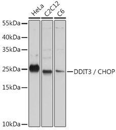 Anti-GADD153 antibody used in Western Blot (WB). GTX32616