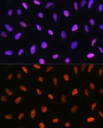 Anti-GADD153 antibody used in Immunocytochemistry/ Immunofluorescence (ICC/IF). GTX32616