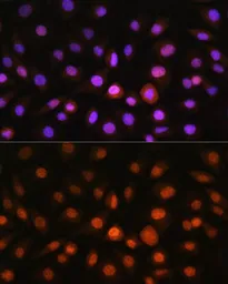 Anti-GADD153 antibody used in Immunocytochemistry/ Immunofluorescence (ICC/IF). GTX32616