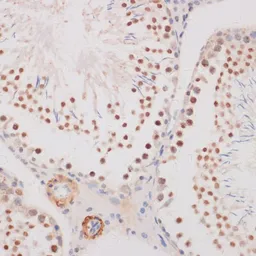 Anti-GADD153 antibody used in IHC (Paraffin sections) (IHC-P). GTX32616