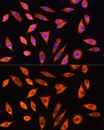 Anti-GALNS antibody used in Immunocytochemistry/ Immunofluorescence (ICC/IF). GTX32618