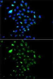 Anti-gamma Catenin antibody used in Immunocytochemistry/ Immunofluorescence (ICC/IF). GTX32619