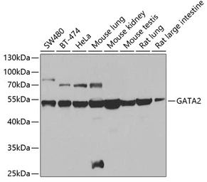 Anti-GATA2 antibody used in Western Blot (WB). GTX32620