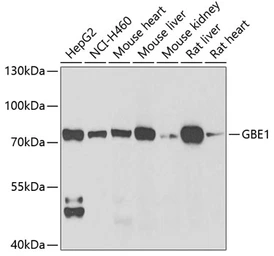 Anti-GBE1 antibody used in Western Blot (WB). GTX32621