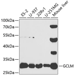 Anti-GCLM antibody used in Western Blot (WB). GTX32622